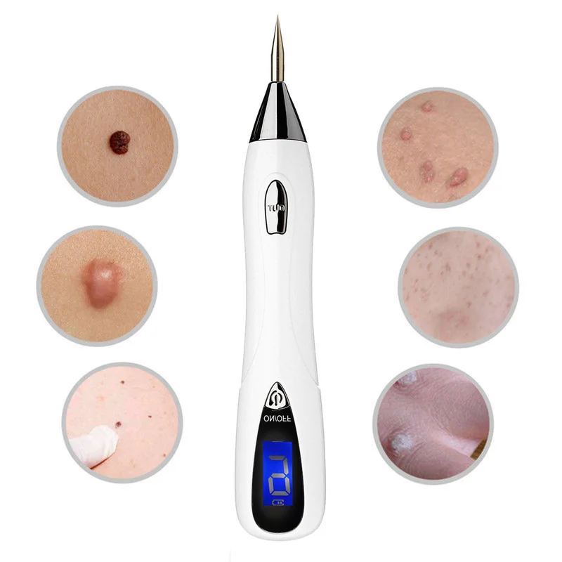 allesxl-12393972