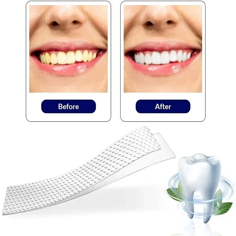 allesxl-32861770